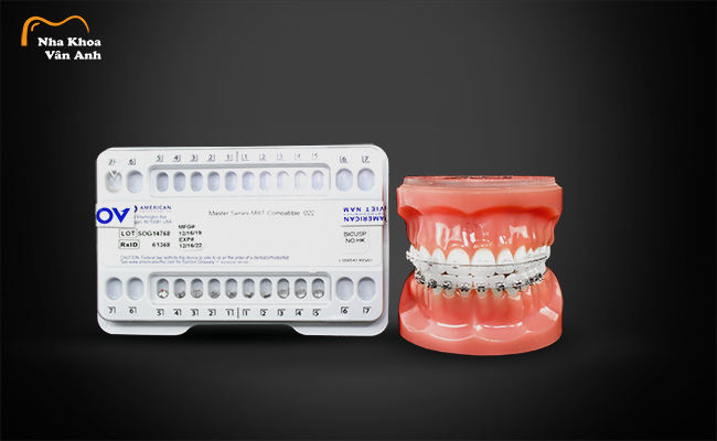 Niềng răng mắc cài kim loại và mắc cài sứ chính hãng tại nha khoa Vân Anh
