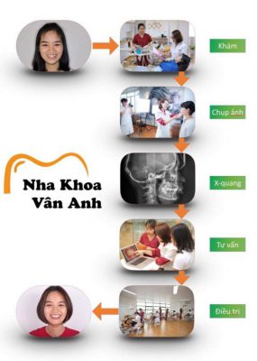 Quá trình chỉnh nha chuẩn quốc tế tại Nha khoa Vân Anh
