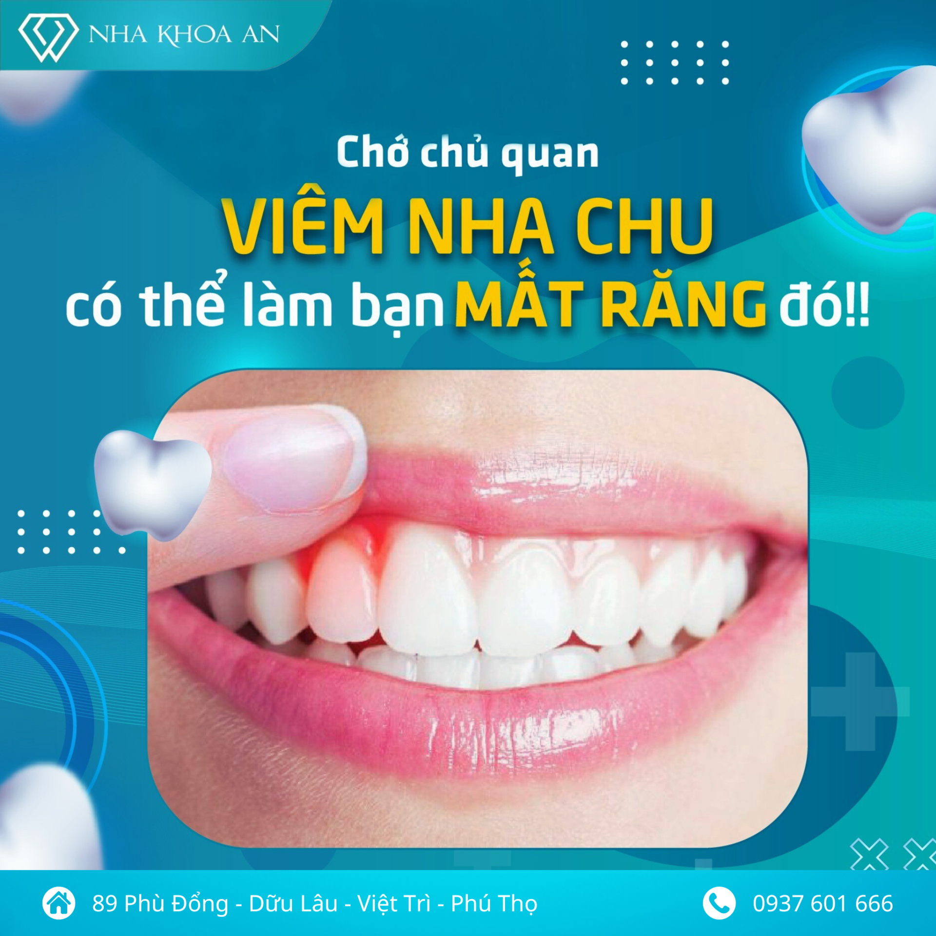 hoi-mieng-du-danh-rang-thuong-xuyen